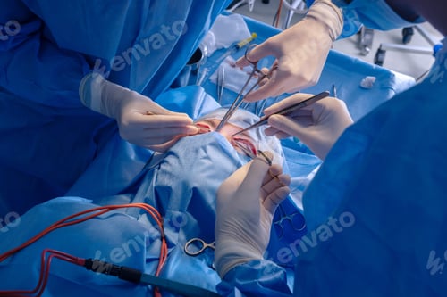 Preview: Close Up of Blepharoplasty Surgery Performed by Surgeons in Modern Clinic Operating Room