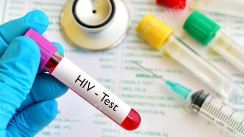 Preview: HIV virus, medical concept, Human Immunodeficiency Virus Positive test