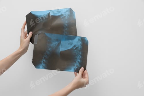 Preview: Doctor examining neck MRI images on light grey background, closeup