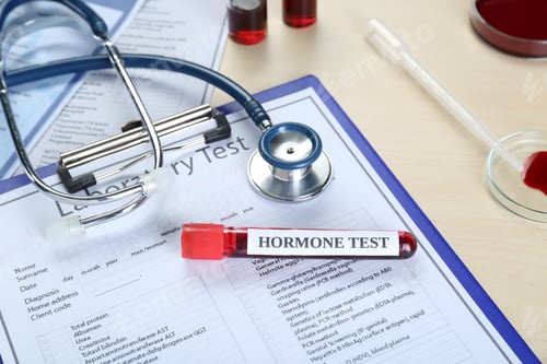 Preview: Hormone test. Sample tube with blood, stethoscope and laboratory form on table, above view