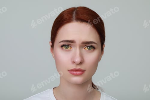 Preview: Upset woman with yellow eyes on light grey background. Symptom of hepatitis