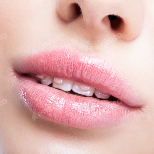 Preview: Closeup Of Woman Open Smiling Mouth With Pink Rose Quartz Lips And Brackets