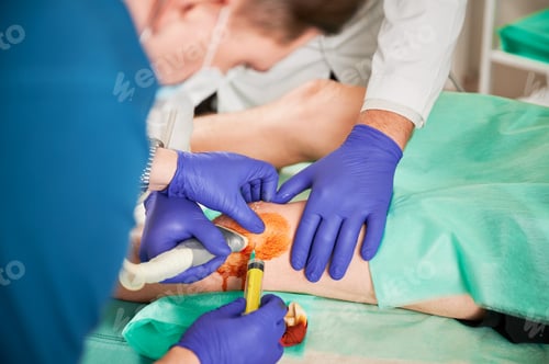 Preview: Doctor and nurse making injection in knee.