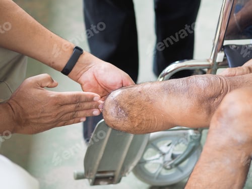 Preview: stump training for prosthesis device