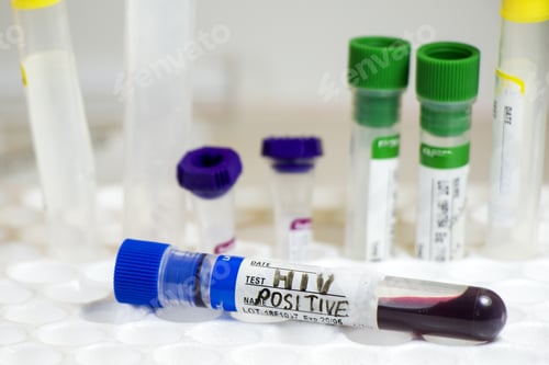 Preview: Selective focus of a tube filled with blood for HIV testing