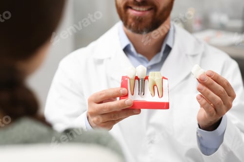 Preview: Doctor with educational model of dental implant consulting patient in clinic, closeup