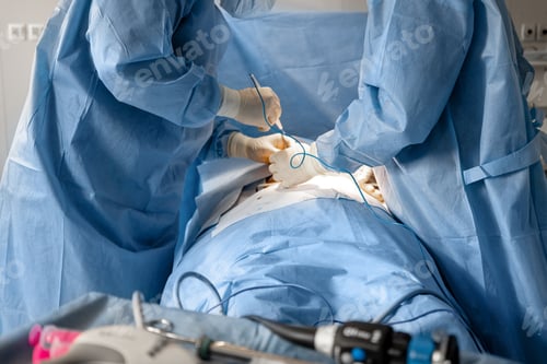 Preview: Two surgeons operates abdominal area of a patient