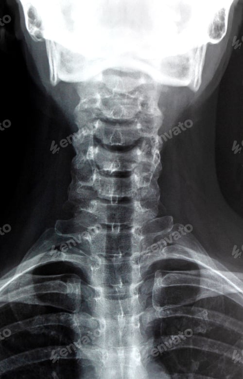 Preview: Medical X ray of a female neck, jaw and spine