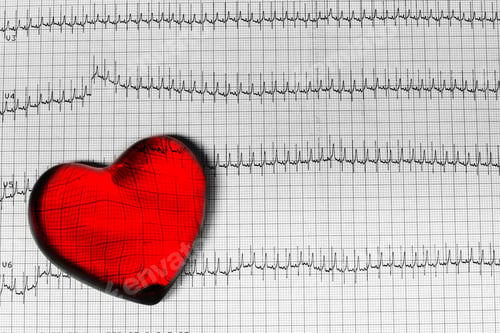 Preview: Knitted red heart on a white textile representing cardiogram
