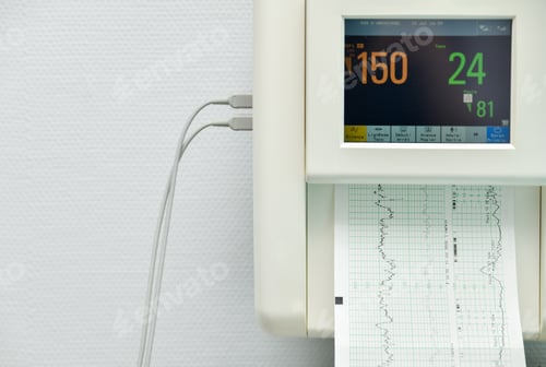 Preview: Monitor for measuring contractions, heartbeat of a pregnant woman in a hospital