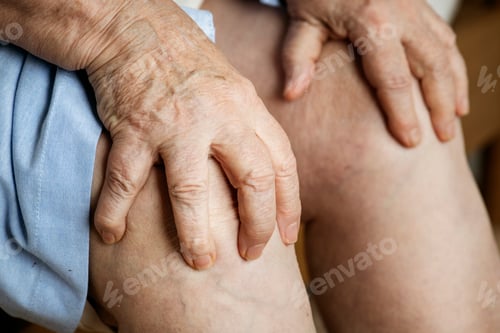 Preview: Elderly woman suffering knee pain
