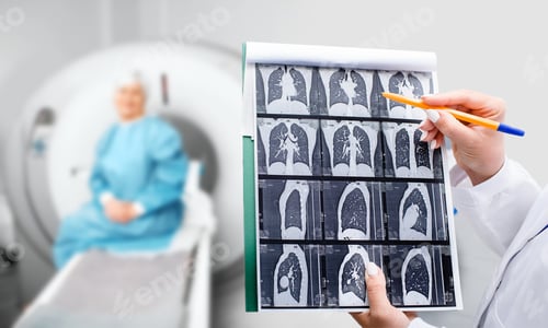 Preview: A healthcare worker examines CT scan images while seated patient awaits results