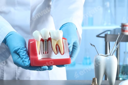 Preview: Dentist holding educational model of gum with dental implant between teeth indoors, closeup