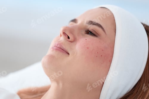 Preview: Woman after face biorevitalization procedure in salon, closeup. Cosmetic treatment