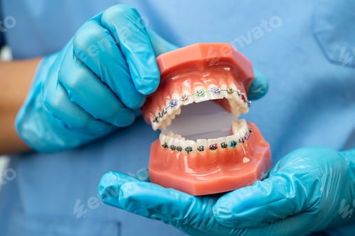 Preview: Denture, dentist holding dental teeth model to study and treat in hospital.