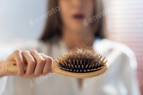 Preview: Hairloss Concept. Worried Woman Holding Comb Full Of Fallen Hair After Brushing