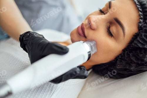 Preview: Microneedle RF lifting procedure. Hardware cosmetology.