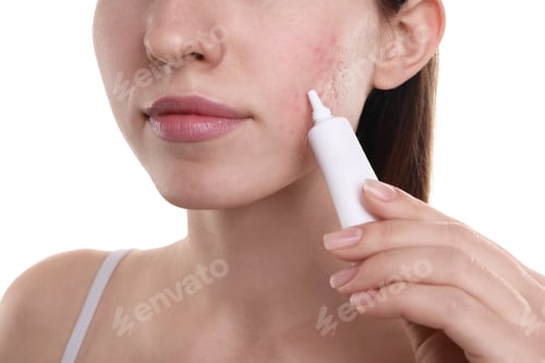 Preview: Young woman with acne problem applying cosmetic product onto her skin on white background, closeup