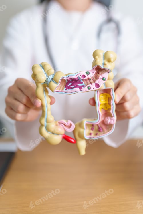 Preview: Doctor with human Colon anatomy model. Colonic disease