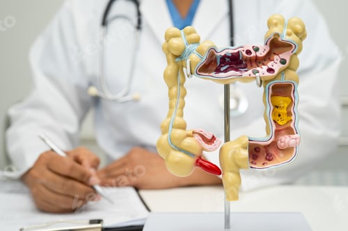 Preview: Intestine, appendix and digestive system, doctor holding anatomy