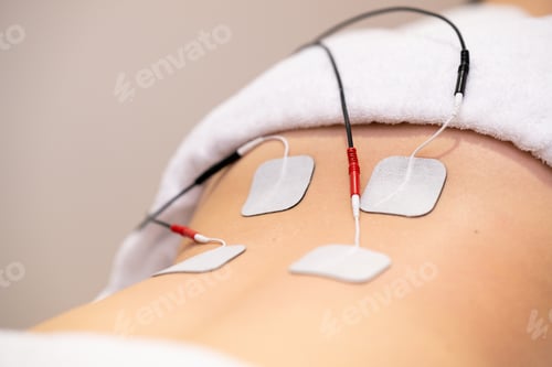 Preview: Electro stimulation in physical therapy to a young woman