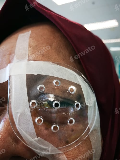 Preview: after cataract eye operation