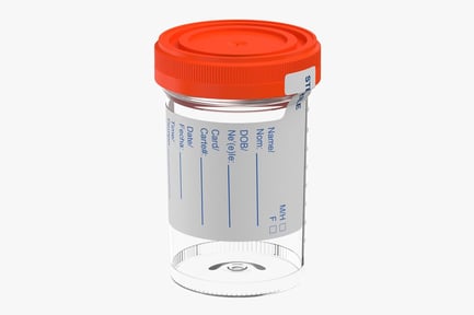 Sterile Specimen Container with Orange Lid