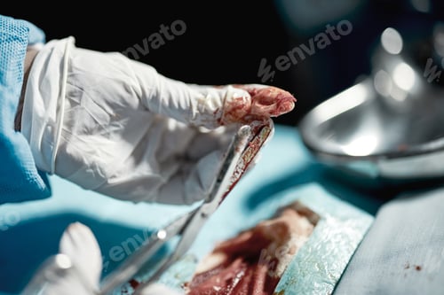 Preview: Surgery wound, doctor hands and medical surgeon scissors with blood at hospital and clinic. Health