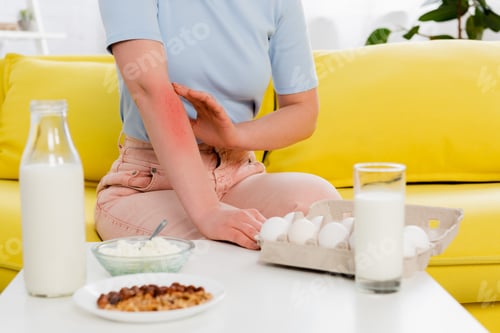Preview: Cropped view of woman with allergy sitting near food on blurred foreground