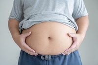 Vorschau: Eine Adipositas, die seinen molligen Bauch von vorne trägt.