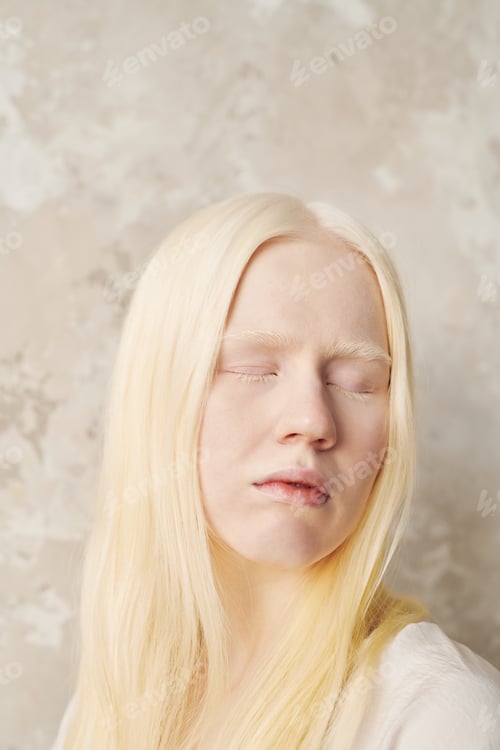 Preview: Young albino woman with pale skin and very fair hair keeping eyes closed