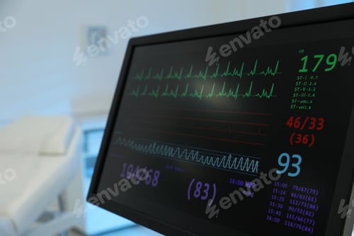 Preview: Monitor with cardiogram in hospital, closeup. Space for text