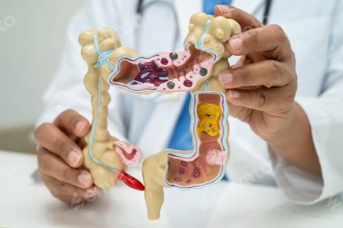 Preview: Intestine, appendix and digestive system, doctor holding anatomy model