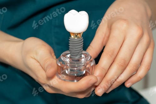 Preview: Dentist holding a dental implant in his hands