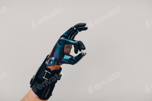 Preview: Young disabled man with artificial prosthetic hand in casual clothes.