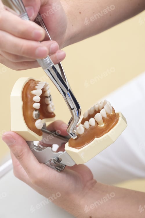 Preview: Tooth Extraction at a Japanese Dentist's Office