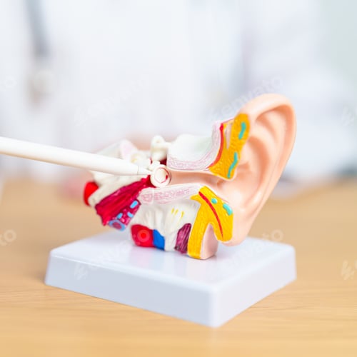 Preview: Doctor with human Ear anatomy model. Ear disease, Atresia