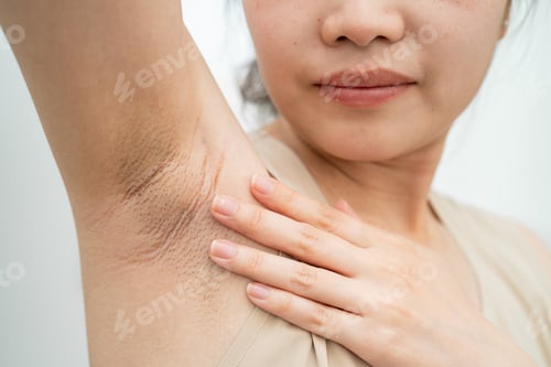 Preview: Asian woman have problem black armpit beauty skin care.