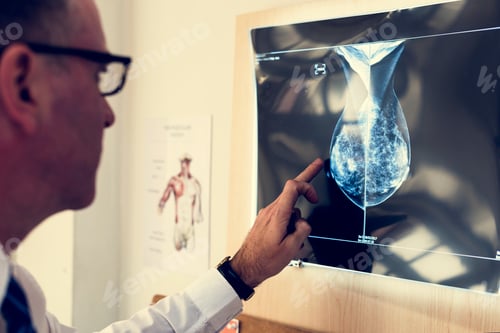 Preview: Doctor is checking patient x-ray film