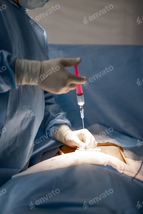 Preview: Surgeon makes an injection during an operation