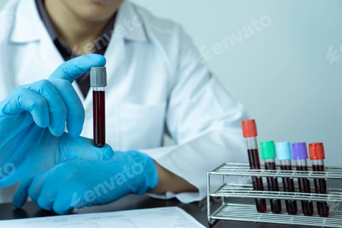 Preview: technician of health with blood tubes in the clinical lab for analytical / hand of a doctor holding