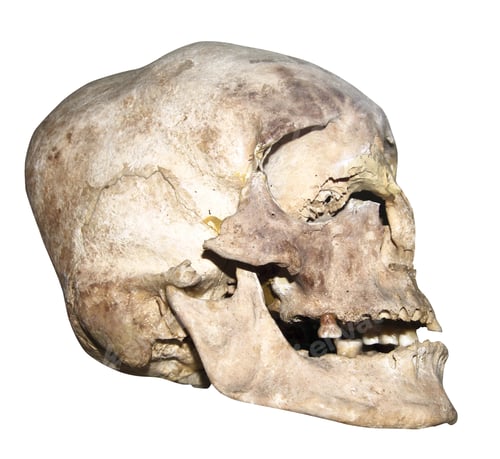 Preview: old human skull
