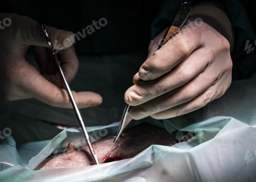 Preview: Closeup shot of doctors working on surgery in the darkroom