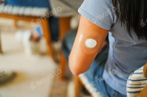 Preview: Young woman with diabetes patch - Lifestyle and people diseases concept - Focus on patch