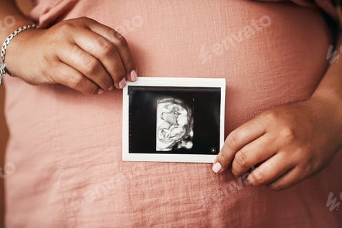 Preview: Closeup shot of an unrecognisable woman holding a sonogram in front of her pregnant belly