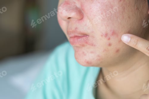 Preview: Close up of Asian girl skin problem,(cheek focusing).