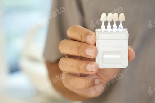 Preview: Dental specialist presenting teeth-whitening kit with samples