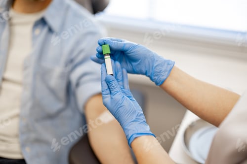 Preview: Man gives blood for tests in laboartory