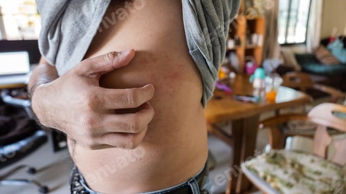 Visualização: Man With Dermatitis Problem Of Rash