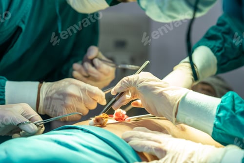 Preview: Close Up Of Surgery Team Doing Surgery With Medical Tools In Operating Room At Hospital. Medical